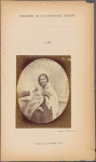 Fig. 80 : Compassionate smile of charity. Benevolent smile, in covering the right side of the face; smile of pity, in covering the left side of the face. Light electrical contraction of m. zygomaticus minor, associated with natural laughter.