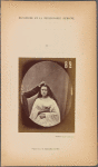 Fig. 82 : Lady Macbeth : Come, you spirits ;; That tend on mortal thoughts, unsex me here, ;; And fill me, from crown to the toe, top-full ;; Of direst cruelty. [Macbeth, act I, scene V] Strong expression of cruelty. Electrical contraction of m. procerus.