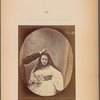 Fig. 83 : Lady Macbeth � about to assassinate King Duncan. Expression of ferocious cruelty. Maximal electrical contraction of m. procerus.