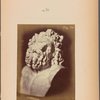 Fig. 70 : Head of Laocoon of Rome. The medial lines of the forehead are in perfect accord with the oblique and curved movements transmitted to the eyebrows by the contraction of m. corrugator supercilii,