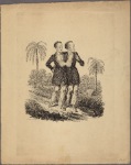 Pair of conjoined twins, standing, each with an arm around the other