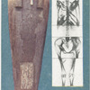 Egyptian mummy X-rayed.