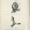 Patent folding urinal. Plates 150-D and 151-D.