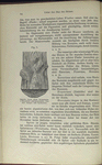 Fig. 8. Schnitte durch einem Baumstamm, a Hirnschnitt oder Querschnitt.