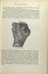 Fig. 9. Maserwuchs der Eiche.