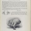 Plate 5002-A and Plate 5002-A. Silentis closet with the sanitary-perfect screw connection