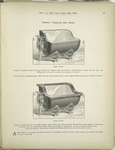 Imperial Porcelain Seat Baths.
