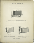 Porcelain-Lined Iron and Oval Porcelain Foot Baths.