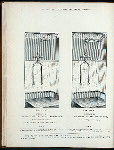 Combination brass needle and tubular shower bath. Plate 1020-G ; Combination brass needle and ring shower bath. Plate 1021-G.