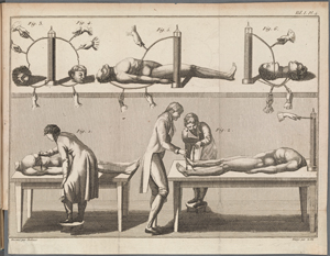 Essai théorique et expérimental sur le galvanisme, avec une série d'expériences faites en présence des commissaires de l'Institut National de France, et en divers amphithéâtres anatomiques de Londres par Jean Aldini