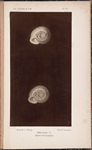 Helix costata