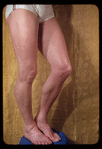 Legs of Anton Dolin