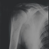 X-ray. New York, NY