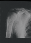 X-ray. New York, NY