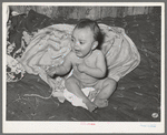 Mexican baby with impetigo. Crystal City, Texas