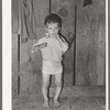 Child with rickets, son of relief client near Jefferson, Texas. This child has never talked though he is two years old. He has never received any medical attention