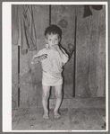 Child with rickets, son of relief client near Jefferson, Texas. This child has never talked though he is two years old. He has never received any medical attention