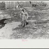 Ten year old child of George Cowley Family (rural rehabilitation client). Her bones break exceptionally easy (diet deficiency said to be one of causes) and one leg has been broken five times and doesn't mend properly. Pike County, Alabama