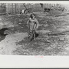 Ten year old child of George Cowley Family (rural rehabilitation client). Her bones break exceptionally easy (diet deficiency said to be one of causes) and one leg has been broken five times and doesn't mend properly. Pike County, Alabama