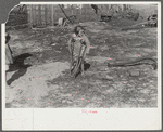 Ten year old child of George Cowley Family (rural rehabilitation client). Her bones break exceptionally easy (diet deficiency said to be one of causes) and one leg has been broken five times and doesn't mend properly. Pike County, Alabama