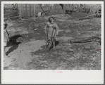 Ten year old child of George Cowley Family (rural rehabilitation client). Her bones break exceptionally easy (diet deficiency said to be one of causes) and one leg has been broken five times and doesn't mend properly. Pike County, Alabama