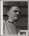 Dutch Gross, ex-world war veteran, trapeze artist, airplane stunt man, friend of "Spike" Conner, the famous blood donor, and the only man to fall out of an airplane at 2000 feet and live (he fell on high tension wire).