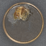 [Douglas-Johnson pin]