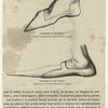 Chaussure du XIIIe siècle ; Chaussure du XIIIe siècle
