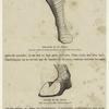 Chaussure du IXe siècle ; Soulier du IXe siècle