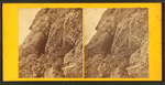 Cave in the lower Lip.
