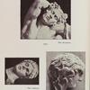 Barberinischer Satyr; Schlafender, Kopf; Erinye, Kopf