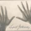 Leopold Godowsky's hand x-rays