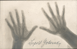Leopold Godowsky's hand x-rays