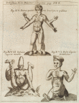 Iconismus XII. Ponatur è regione. Fig. XV. Foetus quaternis brachijs et pedibus; Fig. XVI. Pusio digitis diminutis; Fig. XVII. Infans aperto ventre