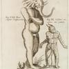 Iconismus IX. Ponatur è regione. Fig. VIII. Puer capite elephantino; Fig. IX. Infans cornutus ore patulo