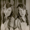 The Hilton twins.